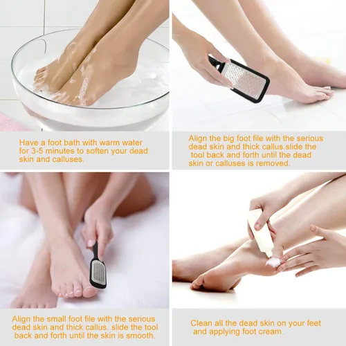 Vista 5 de Removedor de callos para pies, raspador de pies colosal y kit profesional de pedicura para eliminar la piel dura para pies húmedos y secos, lima
