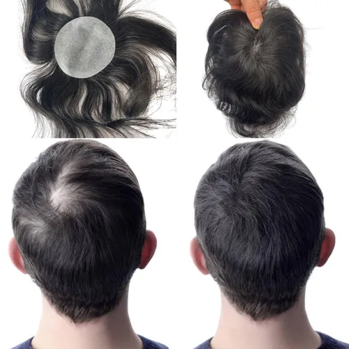 Vista 8 de Voloria Parche para el cabello calvo para hombres, 3.15 x 3.15 pulgadas, sistema de reemplazo de cobertura completa de piel de poliuretano