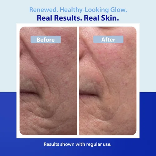 Vista 4 de Dr. Denese Mascarilla reafirmante de colágeno de 4 onzas, tratamiento hidratante para una piel más suave, fórmula exfoliante para poros más claros