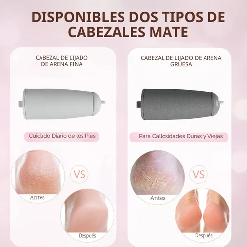 Vista 3 de Haootadiy - Quitadores eléctricos de callos para pies, kits de pedicura para eliminar callos de pies eléctricos recargables con 12 en 1, elimina