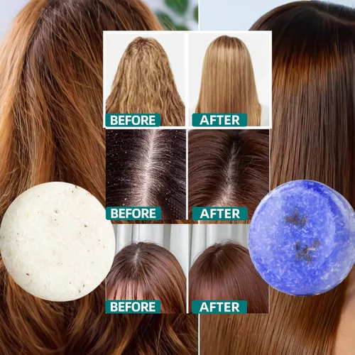 Vista 3 de DBEAUTYM Paquete de 2 barras de champú para el cabello con lavanda y romero, limpieza profunda para la pérdida de cabello del cuero cabelludo