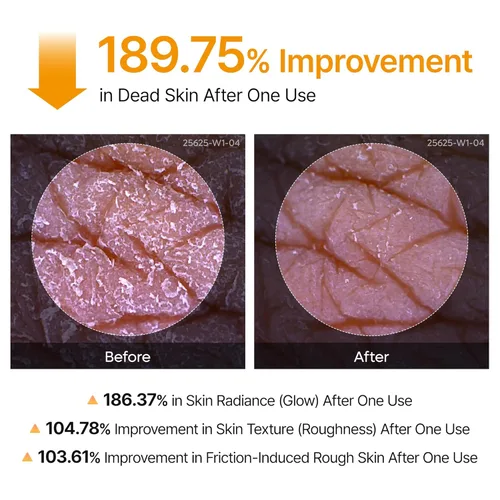 Vista 6 de Dr.Melaxin Cuidado de Queratina Corporal Ácido Kójico Cúrcuma Spray Exfoliante Suave Solución Peeling Cuidado de la Piel Coreano Para Todos Los