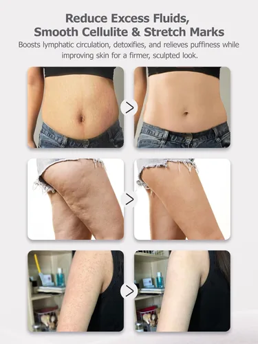 Vista 5 de Masajeador de drenaje linfático y herramienta de masaje anticelulitis, ayuda a reducir las estrías y la celulitis, para piernas, brazos y vientre