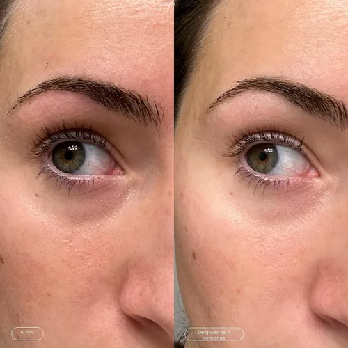 Vista 5 de Topicals Faded Máscaras Iluminadoras para Debajo de los Ojos Parches para Desinflar, Hidratar, Iluminar y Enfriar Reduce las Ojeras y Líneas