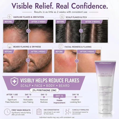 Vista 2 de DERMAdoctor - Limpiador de tranquilidad de zinc piritiona al 2%, máxima fuerza OTC para dermatitis seborreica, caspa y enrojecimiento Cara, cuero