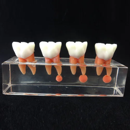 Vista 3 de Modelo de dientes dentales Modelo de tratamiento endodóntico de 4 etapas para estudiar y enseñar..