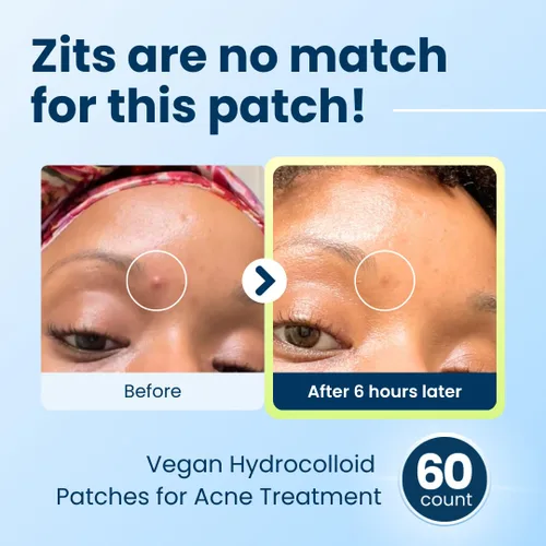 Vista 3 de CLEAN SKIN CLUB 60 parches invisibles veganos para espinillas, Derma Dot hidrocoloide para cubrir zits, puntos negros, imperfecciones, adhesivo