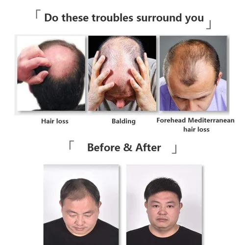 Vista 5 de Extensiones de pelo de encaje atadas a mano para hombres (7.9 x 8.7 pulgadas 2#, negro natural) Cabello humano, clip en la parte superior Hai