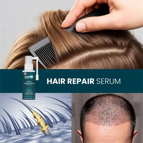Vista 8 de HairMD Transplant Clinical Repair Serum - Suero de recrecimiento del cabello de 2.0 fl oz - Previene la pérdida de cabello después del trasplante