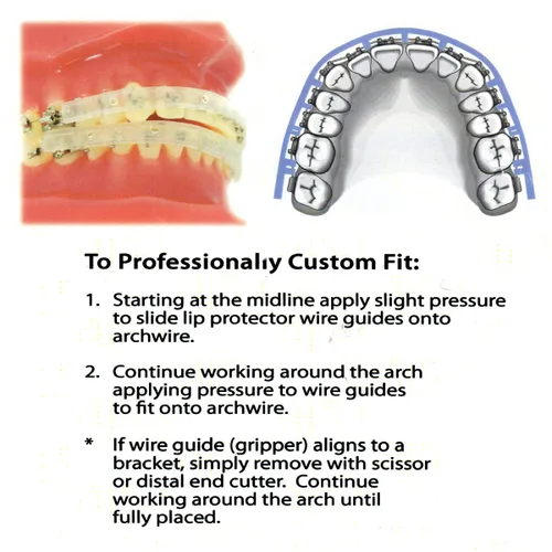 Vista 2 de Nuestros aparatos dentales más vendidos, escudo protector (1 juego, superior y dientes inferiores)
