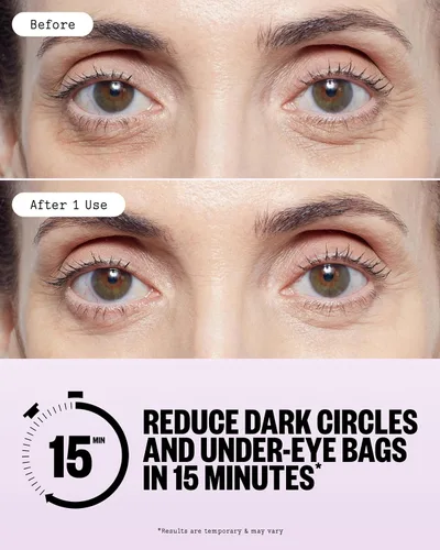 Vista 4 de PEACE OUT Skincare Parches para ojos hinchados, Máscara de biocelulosa para debajo de los ojos, Minimiza la hinchazón y los ojos cansados