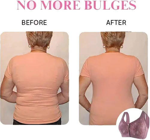 Vista 8 de Wmstylist.Com Brasier de estilista Wm para personas mayores, cierre frontal, glamorette con cierre frontal para mujer poscirugía