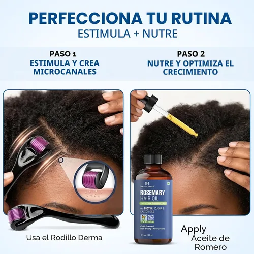 Vista 3 de Botanic Hearth - Aceite de romero para el crecimiento del cabello, 2 onzas líquidas con rodillo Derma Enriched with Biotin, Castor & Jojoba Hair