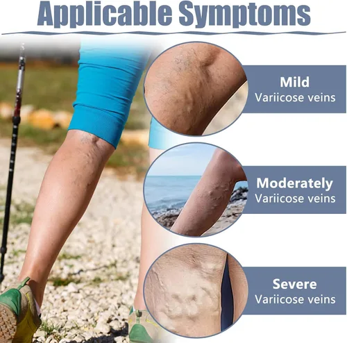 Vista 6 de 36 parches para venas varicosas, tratamiento natural de alivio para piernas, araña, varices, fortalece la salud capilar y mejora la circulación