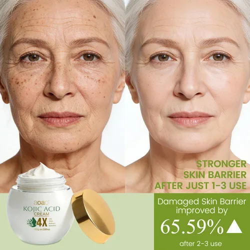 Vista 4 de AOAO Crema de estiramiento facial para mujeres, reafirma y nutre la piel, niacinamida para hidratar, suavizar la piel áspera, tratamiento hidratante