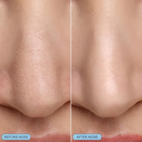 Vista 3 de Bioré Mascarilla de nariz burbujeante para refinar poros, ácido glicólico y ácido hialurónico exfoliante para cara, mascarilla limpiadora de poros