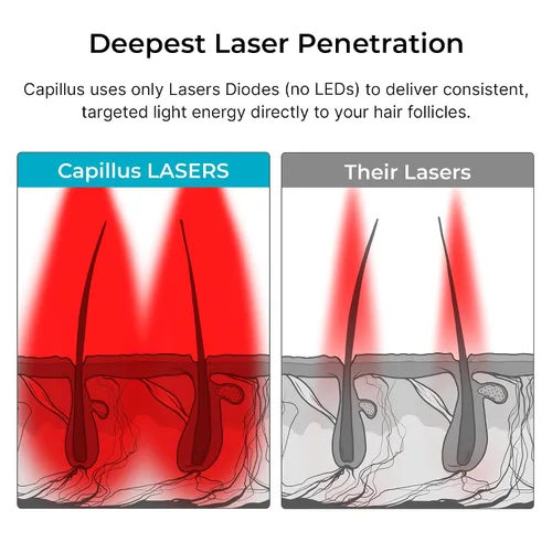 Vista 10 de Capillus Pro S1 - Gorra láser para terapia de luz roja, para el crecimiento