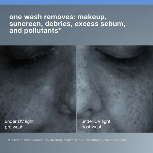 Vista 3 de Dermalogica Limpiador total Oil To Foam para la cara – Elimina el maquillaje, el protector solar y los desechos mientras limpia la piel en un solo
