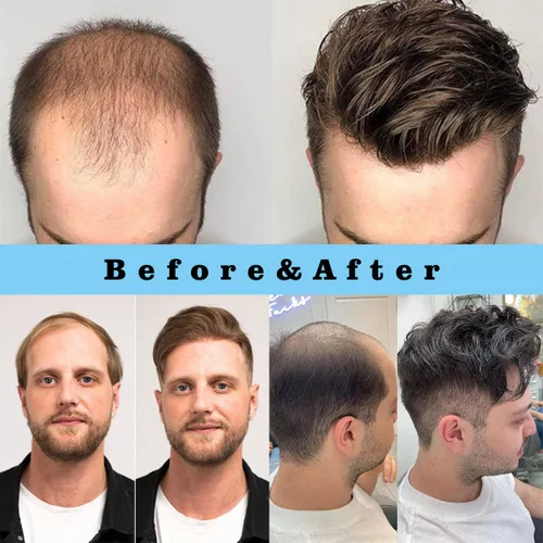 Vista 6 de Toupee para hombres, 8x10 pulgadas 0.002 in piel sintética fina para hombre, cabello humano tipo tupé, rubio sucio para hombre, peluca de cabello