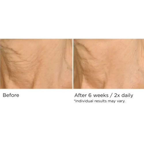 Vista 12 de NassifMD Deco-Lift Neck & Decollete Firming & Lifting Complex