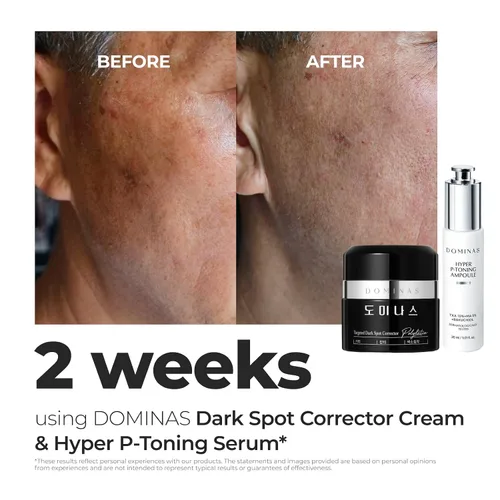 Vista 11 de DOMINAS Crema correctora de manchas oscuras Fórmula avanzada con niacinamida, TXA, hexilresorcinol y bakuchiol para reducir visiblemente