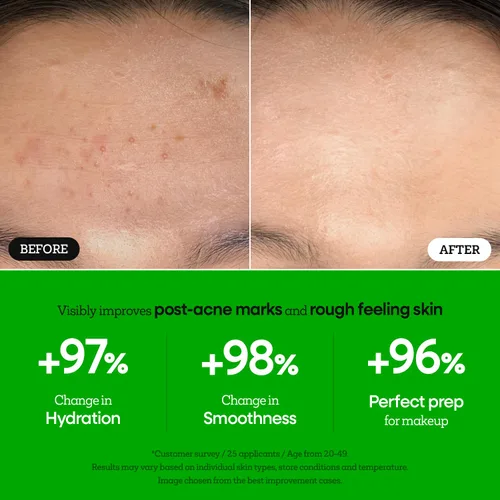 Vista 4 de Nature Republic The First Peptide Boosting Serum - Niacinamida, adenosina, suero facial hidratante y reafirmante, para líneas finas y poros, cuidado
