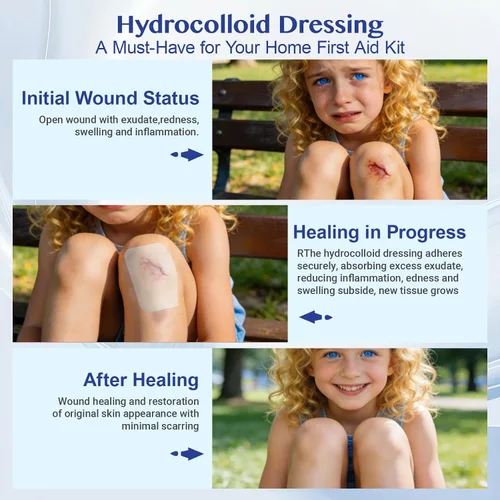 Vista 8 de Rollo hidrocoloide para el cuidado de heridas, vendajes hidrocoloides de 2 pulgadas x 5 pies con autoadhesivo, cortado a medida, ultra absorbente