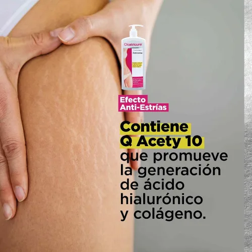 Vista 4 de Cicatricure Crema antiestrías, 13.6 onzas líquidas, hidratante de cuerpo entero para todos los tonos de piel