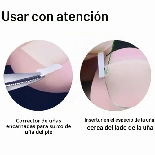 Vista 8 de Kit de tiras correctoras de uñas encarnadas, 10 piezas de tiras correctoras de uñas encarnadas, tiras alisadoras de uñas encarnadas, clips