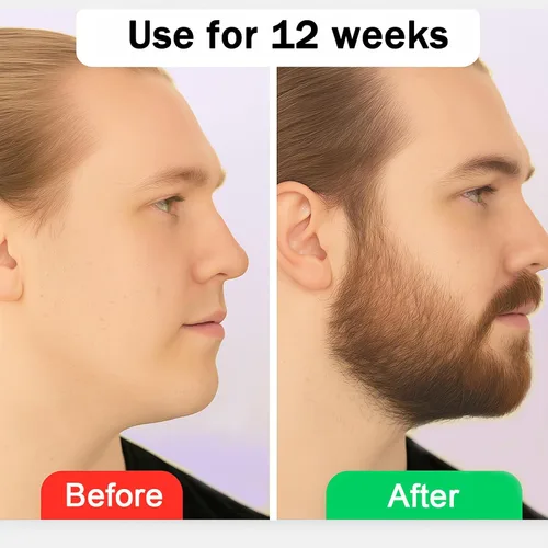 Vista 5 de Estimulante para Barba – Bálsamo de Crecimiento Ultra Potente, Bálsamo Estimulante para Barba, Hidrata y Fortalece la Barba, 100 ml / 3.5 oz