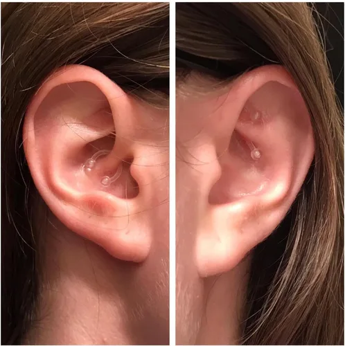 Vista 2 de FECTAS Retenedores para cartílago, hélix, daith, tragus, nariz, labio, ceja, anillos transparentes Bioflex 16G 5/16