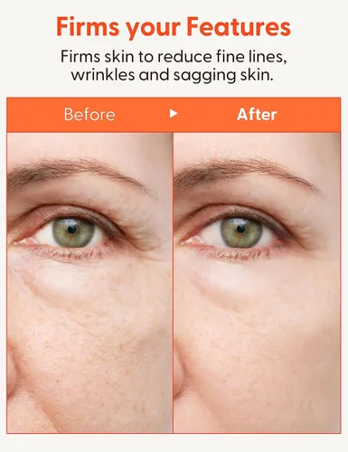 Vista 5 de It'S SKIN Emulsión de colágeno nutritivo: volumen de colágeno marino y loción facial reafirmante, revitalizante intenso y elasticidad para pieles