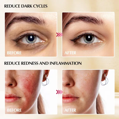 Vista 5 de Gua Sha Cryo Sticks 2 en 1, herramientas para el cuidado facial de la piel para mujeres, masaje facial y de ojos, suministros esteticistas de acero