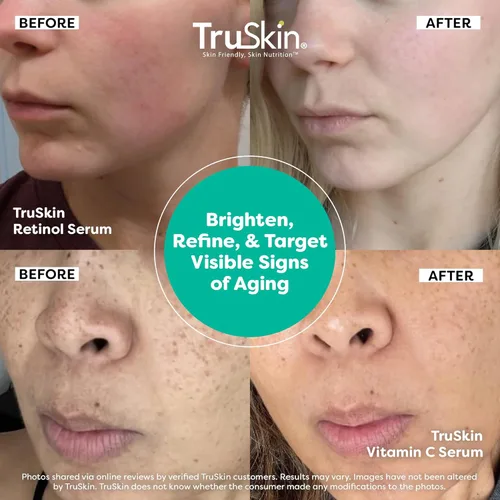 Vista 4 de TruSkin Naturals Suero facial Duo - Suero de retinol para la cara y suero de vitamina C antienvejecimiento para el cuidado de la piel para mujeres