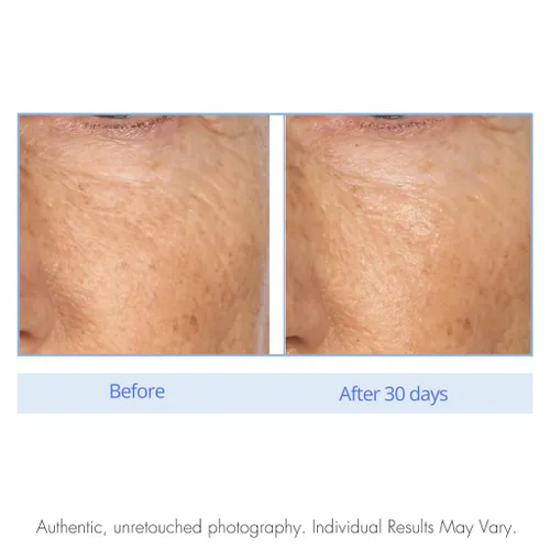 Vista 4 de Serious Skincare - Almohadillas de tratamiento de exfoliación de retinol para una piel más suave, palmitato de retinilo, vitamina A