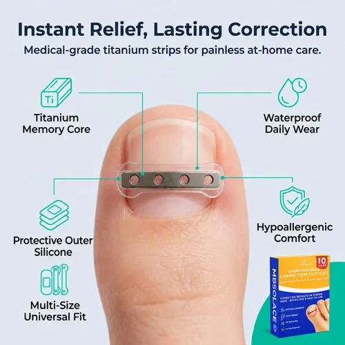 Vista 3 de Kit de tratamiento y corrector de uñas encarnadas de aleación de titanio de alta calidad, tiras correctoras hipoalergénicas para uñas de los pies