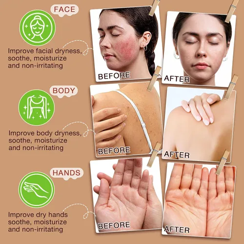 Vista 8 de GOGIFTGO Sarga de ternera para la piel, sebo y bálsamo de miel, sarga de res para la cara, hidratante facial de caldo, hidratante natural hidrata