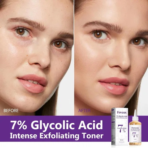 Vista 4 de Tónico exfoliante de ácido glicólico al 7%, tónico facial exfoliante para el cuidado de la piel, mejora la textura, reduce los brotes de poros