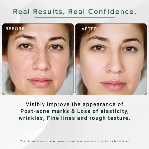 Vista 5 de Suero facial Brightening & Glow con alfa arbutina al 2% + ácido hialurónico 10% – Reduce las manchas oscuras y líneas finas, suero de hidratación