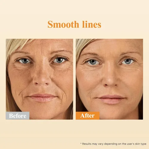 Vista 7 de Triple Retinol Serum para la cara – Anti-envejecimiento arrugas noche retinol +HPR cápsulas, suero peptídico para mujeres, reduce líneas finas