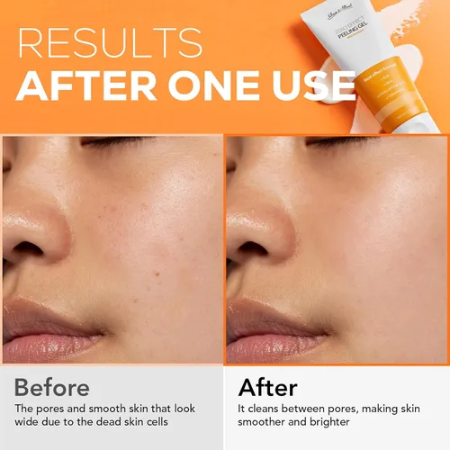 Vista 5 de Olivia & Allison ZERO EFFECT PEELING GEL 3.38fl oz (100ml) Natural BHA + AHA + Gel exfoliante de ceramida