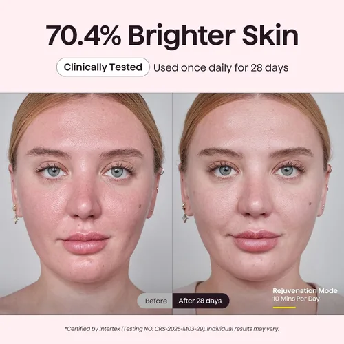Vista 6 de Wavytalk Máscara de terapia de luz roja para cara, ELLE mejor herramienta Rosa