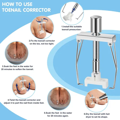Vista 4 de Kit de eliminación de uñas encarnadas, tratamiento profesional de uñas encarnadas, incluye corrector de uñas encarnadas, pinzas, 50 parches