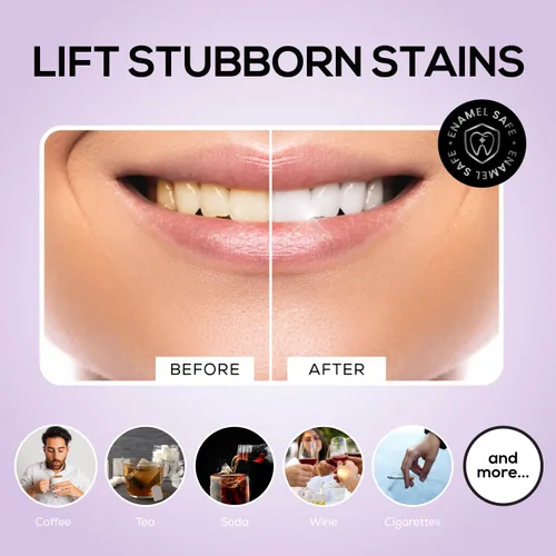 Vista 5 de Venus Visage Pasta de dientes de carbón activado para blanquear, paquete de 3 – Pasta dental eficaz para blanquear los dientes para manchas