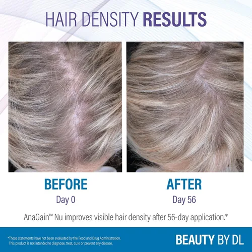 Vista 7 de Douglas Laboratories Crecimiento del cabello+ Promueve el grosor y reduce la pérdida 60 cápsulas vegetarianas