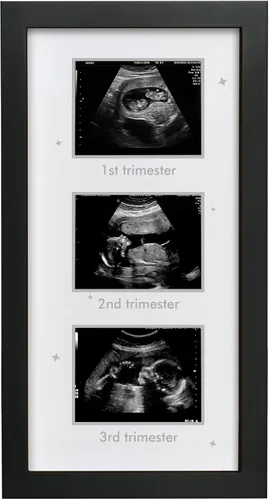 Vista 8 de Marco de fotos de ultrasonido – Marco de triple ecograma para la futura mamá Decoración de álbum de fotos de embarazo Artículos esenciales