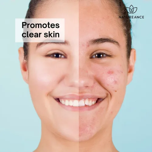 Vista 4 de Exfoliante facial de árbol de té (4 onzas líquidas) - Exfoliante para piel propensa al acné