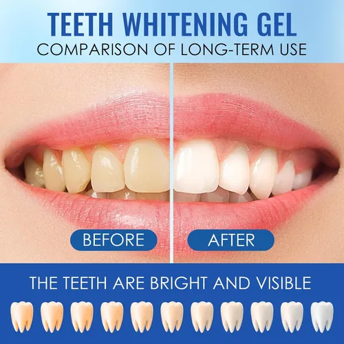Vista 6 de Paquete de 10 repuestos de gel blanqueador de dientes, kit de recarga de blanqueamiento de dientes de gel, blanqueador de dientes, gel blanqueador