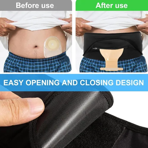 Vista 3 de Cinturón de ostomía, paquete de 2 unidades, funda para bolsa de ostomía para cinturón invisible, suministros de ostomía con bolsas de colostomía