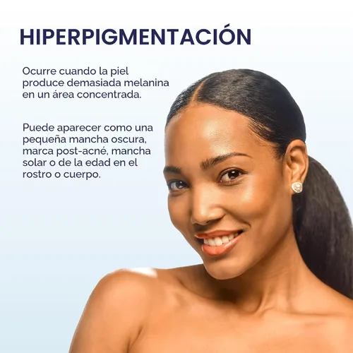 Vista 7 de Palmer's Skin Success Loción corporal, leche antimanchas oscuras (8.5 onzas) Moisturizer with Niacinamide, Fades Age Spots, Helps Uneven Skin Tone